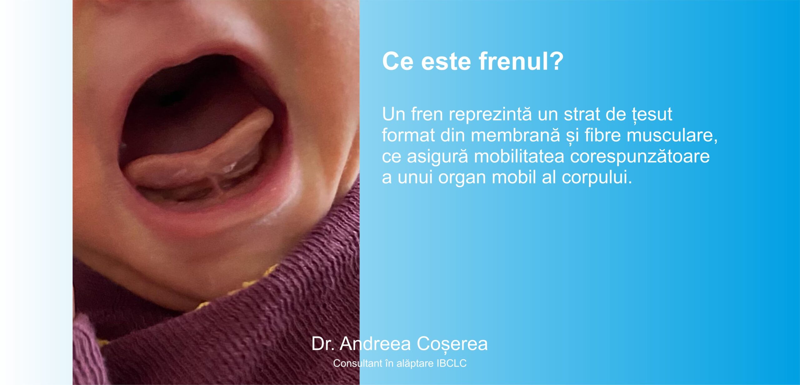 Frenul la sugari: simptome, și tratament - Dr. Andreea Coșerea