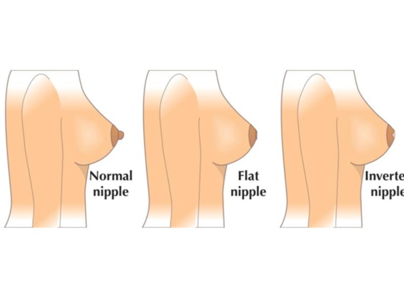 Tipuri de mameloane si rolul lor